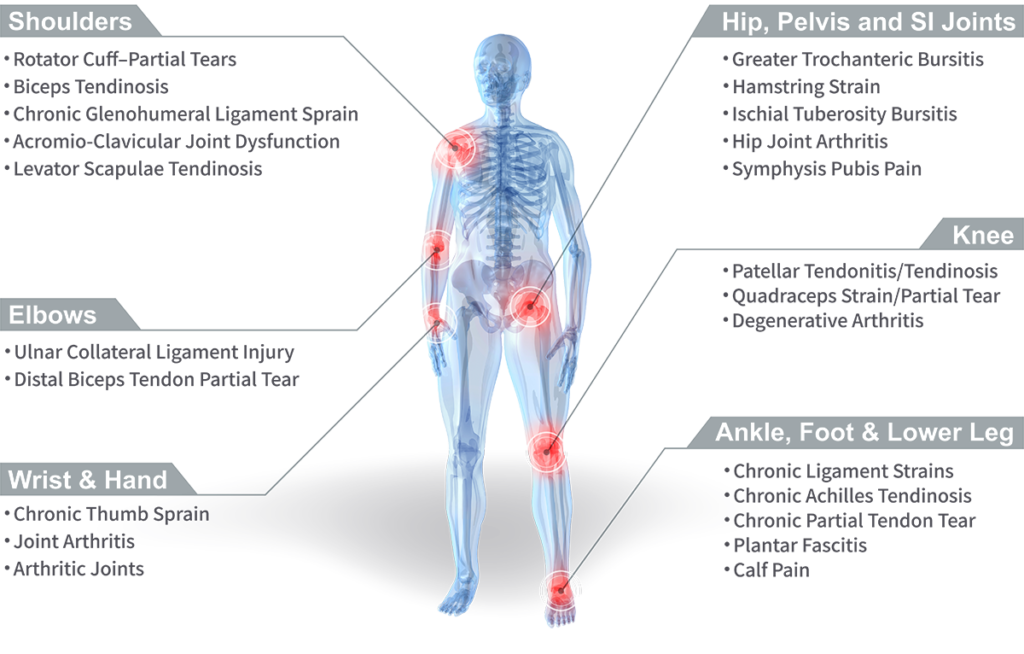 Stem Cell Treatment For Joint Pain - Ashmore Osteopathic GroupAshmore ...