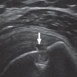 Musculoskeletal Ultrasound - Ashmore Osteopathic GroupAshmore ...