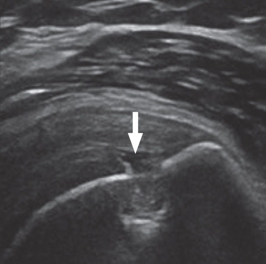 Musculoskeletal Ultrasound Ashmore Osteopathic GroupAshmore