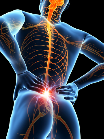 Prolotherapy - Low Back Pain and Sciatica