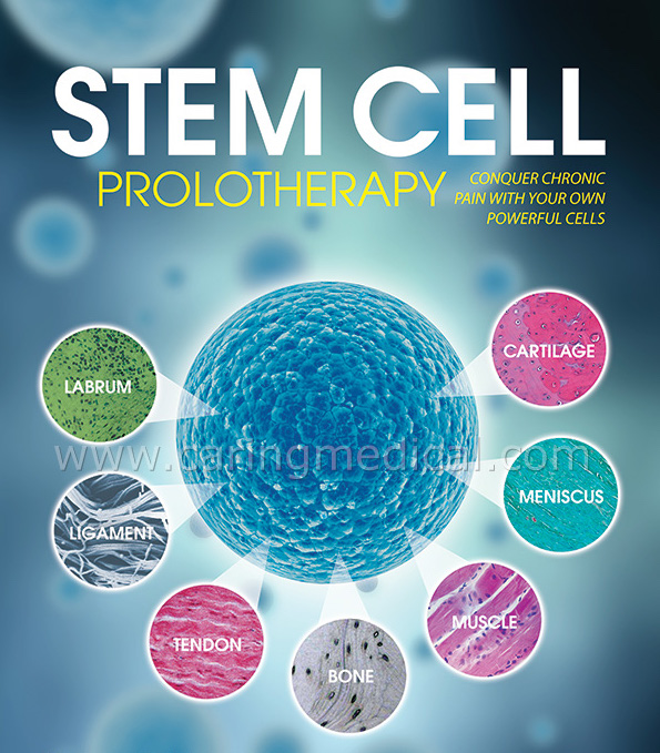 Office-Based Harvest of Mesenchymal Stem Cells - Ashmore Osteopathic ...